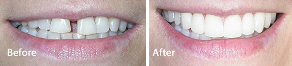 Shine Dental Care Nottinghamshire